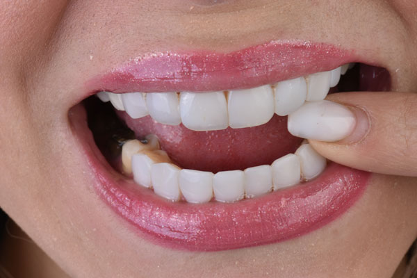 اهمیت انتخاب دندانپزشکی مناسب