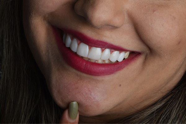 درمان های رایج در دندانپزشکی بزرگسالان