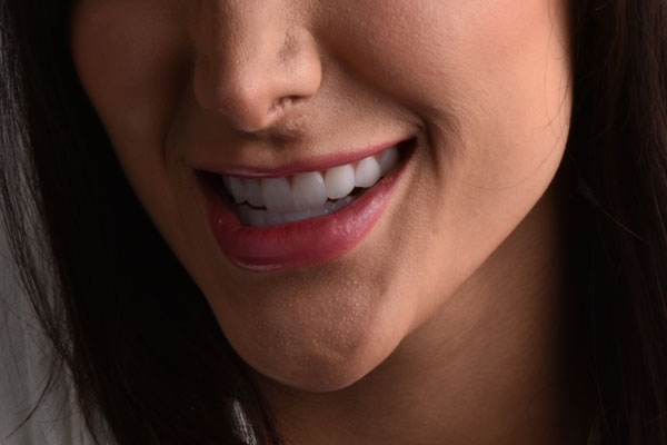 خدمات لثه و درمان بیماری‌ های پریودنتال