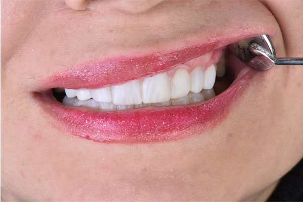 دندانپزشکی بزرگسالان