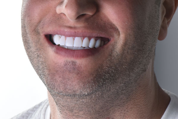 اهمیت درمان به موقع در دندانپزشکی