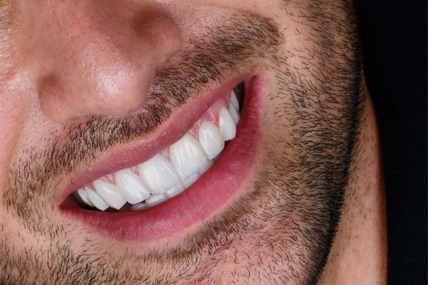 کلینیک ریرا بهترین انتخاب برای دندانپزشکی اطفال