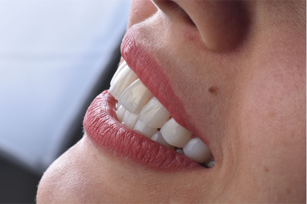 ویژگی های برجسته کلینیک دندانپزشکی ریرا