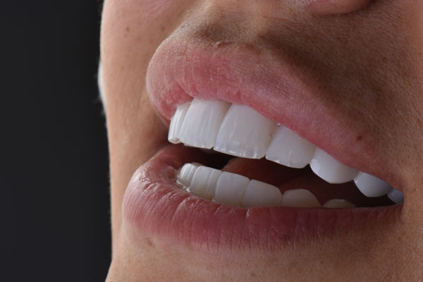 خدمات تخصصی زیبایی در گیلاوند